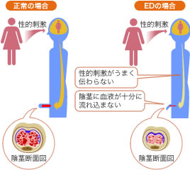 EDのメカニズム
