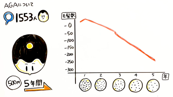 放置したらどうなる？AGA発症後の経過