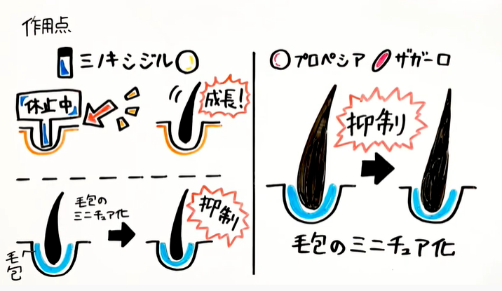 ミノキシジルの作用点とプロペシアザガーロの作用点