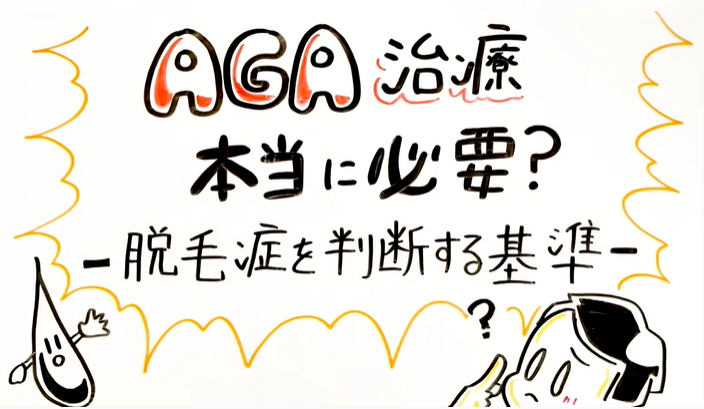 AGA治療は本当に必要？判断基準について