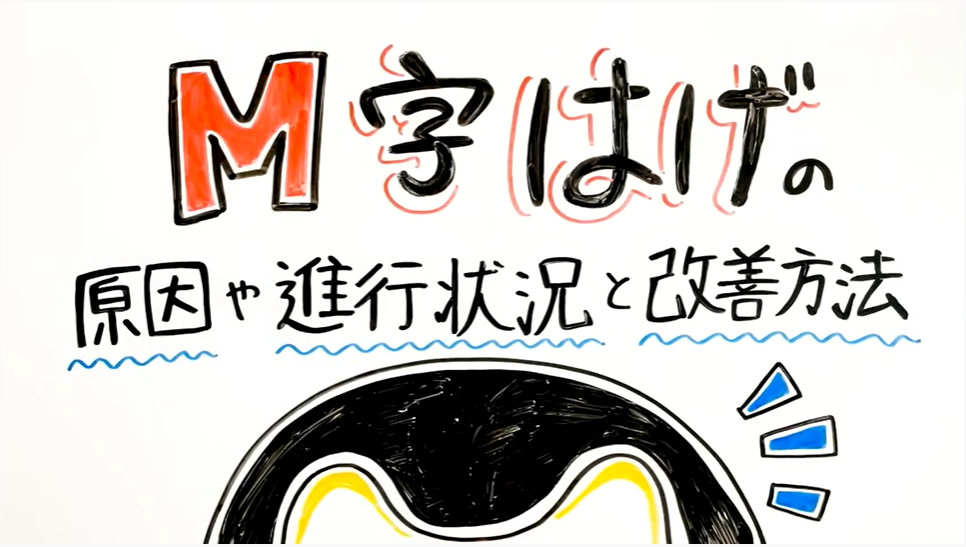 M字はげの原因や進行状況と改善方法について！