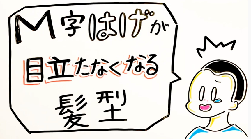 M字はげが目立たなくなる髪型