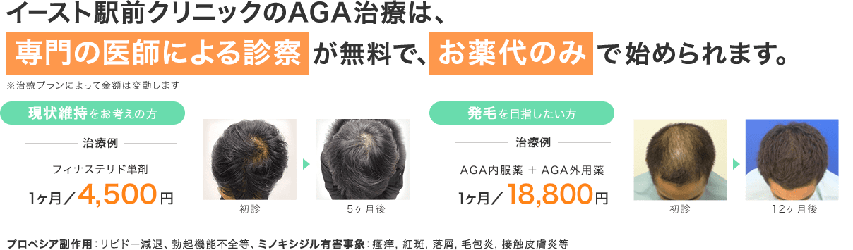 イースト駅前クリニックのAGA治療は、専門の医師による診察が無料で、お薬代のみで始められます。