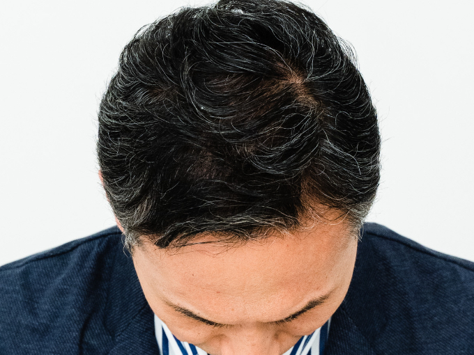 After画像