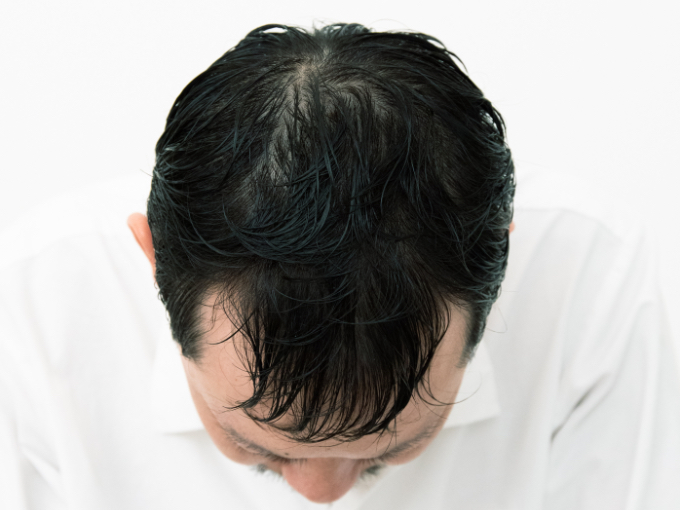 Before画像
