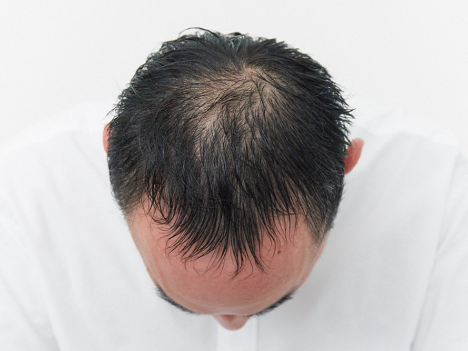 Before画像