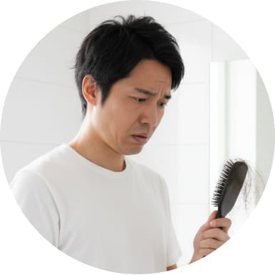 ミノキシジル