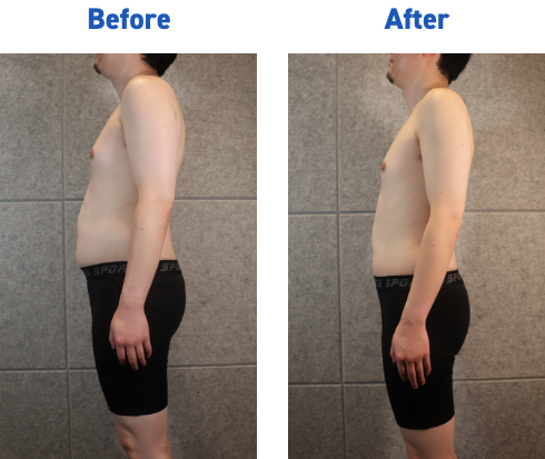 20代 メディカルダイエット症例