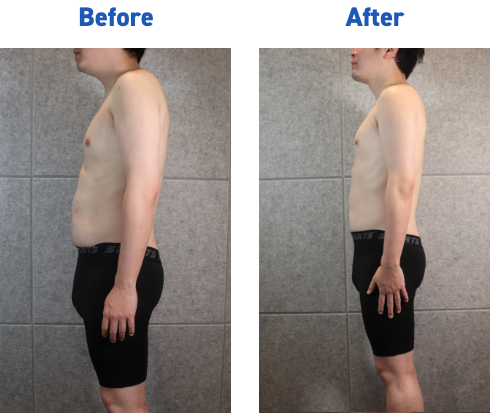 20代 メディカルダイエット症例