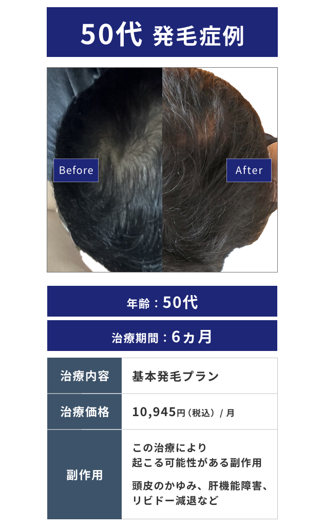 SP Image 2