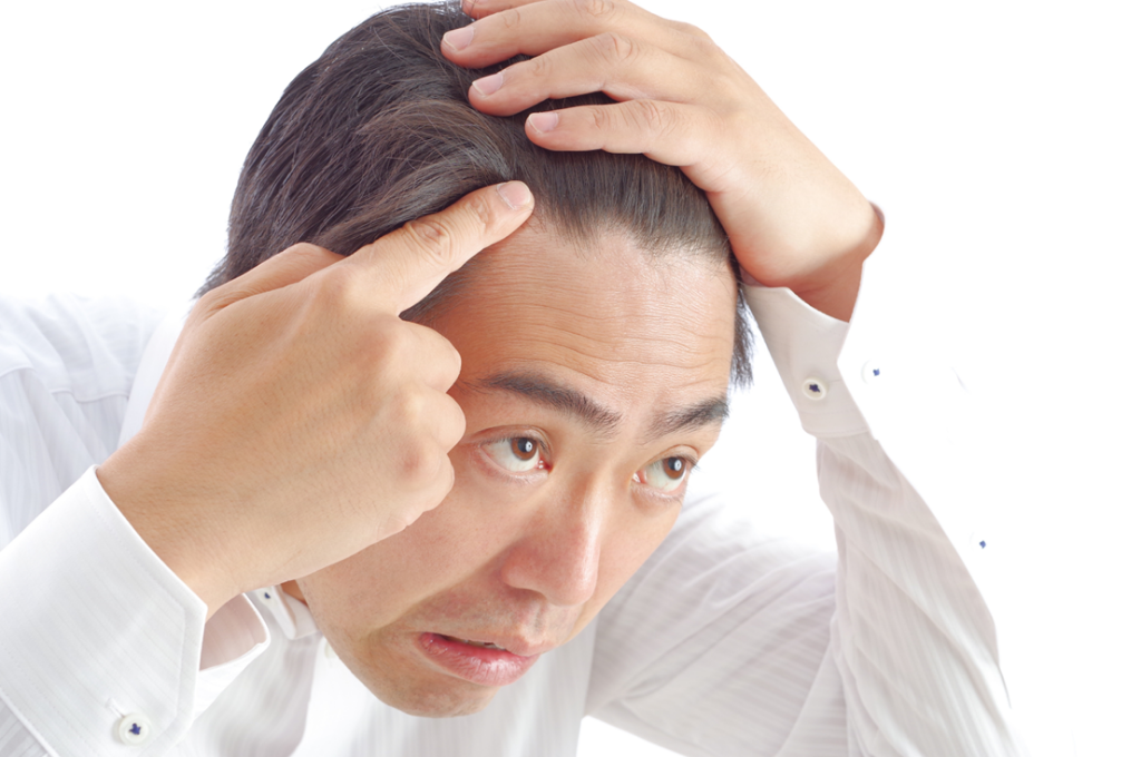 ミノキシジルをやめるとどうなる？AGAは進行する？